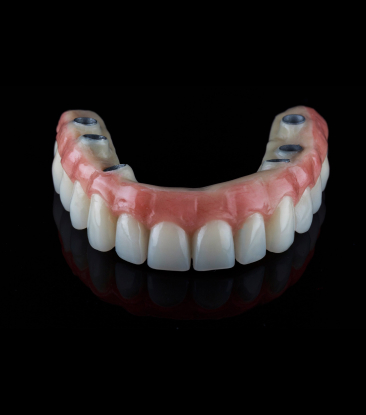 Fixed Hybrid Zirconia Implant Bridge 